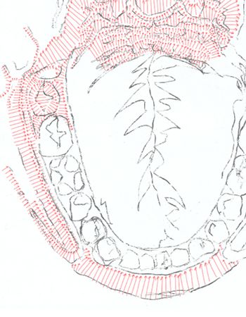 Overlaid charcoal and arrow contours of a jaw bone